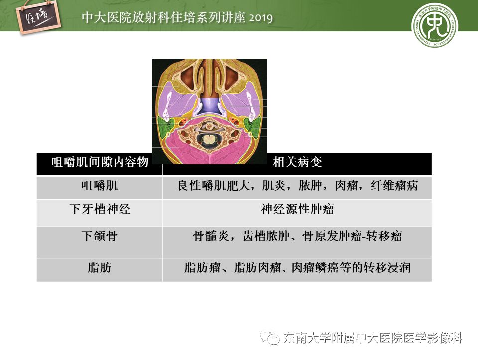 【PPT】颈部间隙的影像解剖及诊断思路