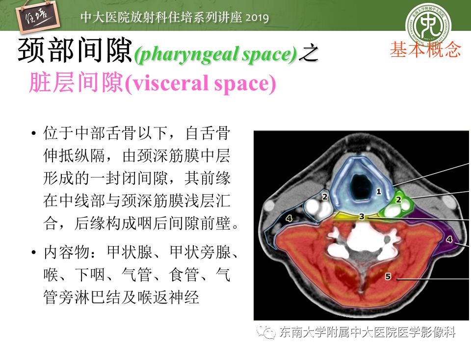 【PPT】颈部间隙的影像解剖及诊断思路