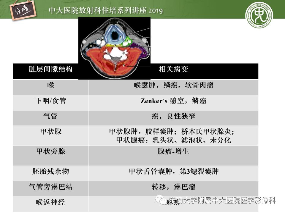【PPT】颈部间隙的影像解剖及诊断思路