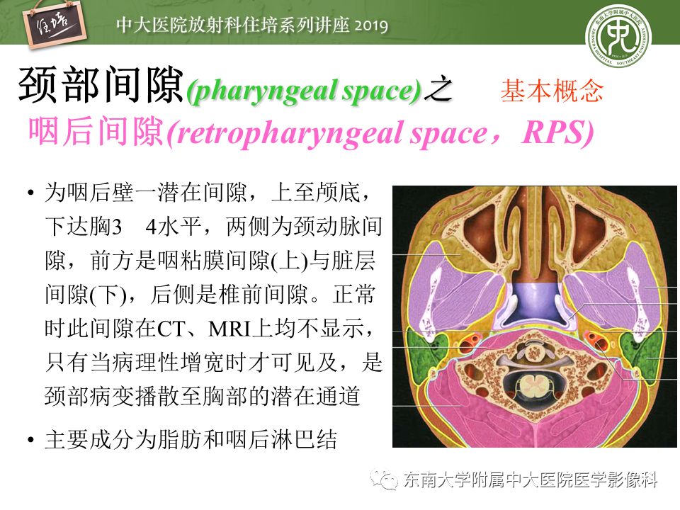【PPT】颈部间隙的影像解剖及诊断思路