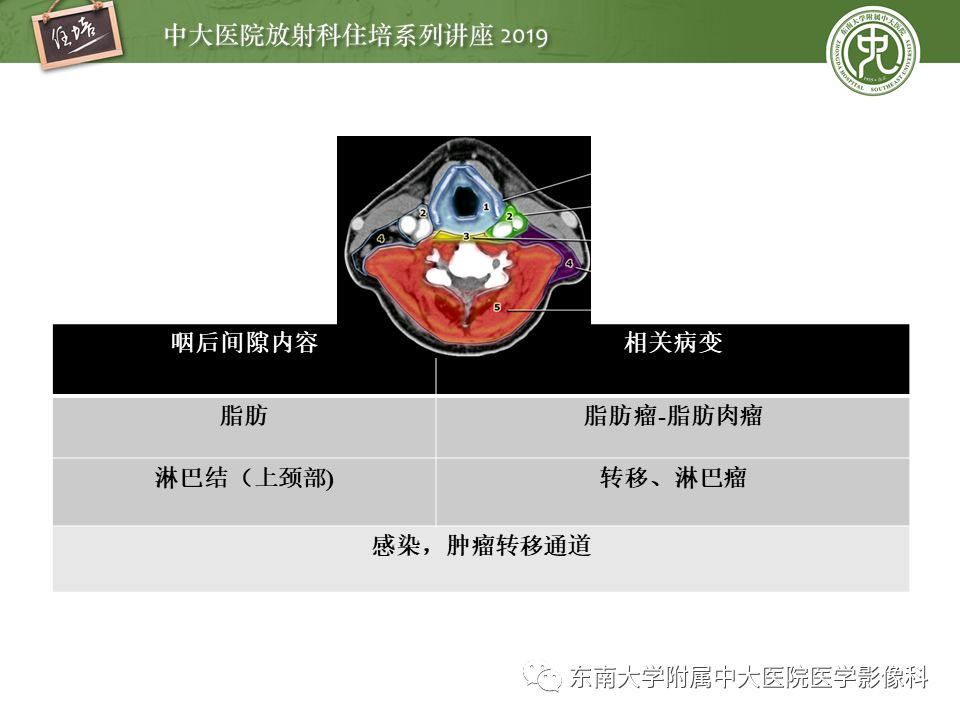 【PPT】颈部间隙的影像解剖及诊断思路