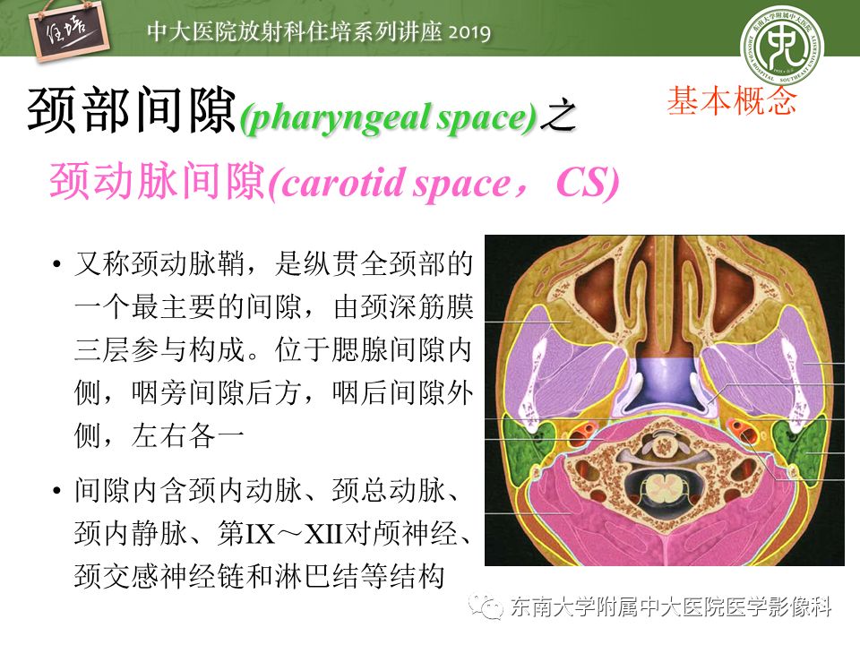 【PPT】颈部间隙的影像解剖及诊断思路