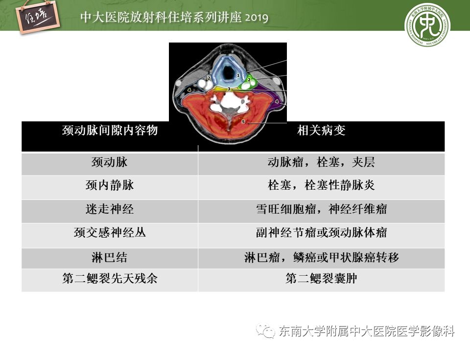 【PPT】颈部间隙的影像解剖及诊断思路