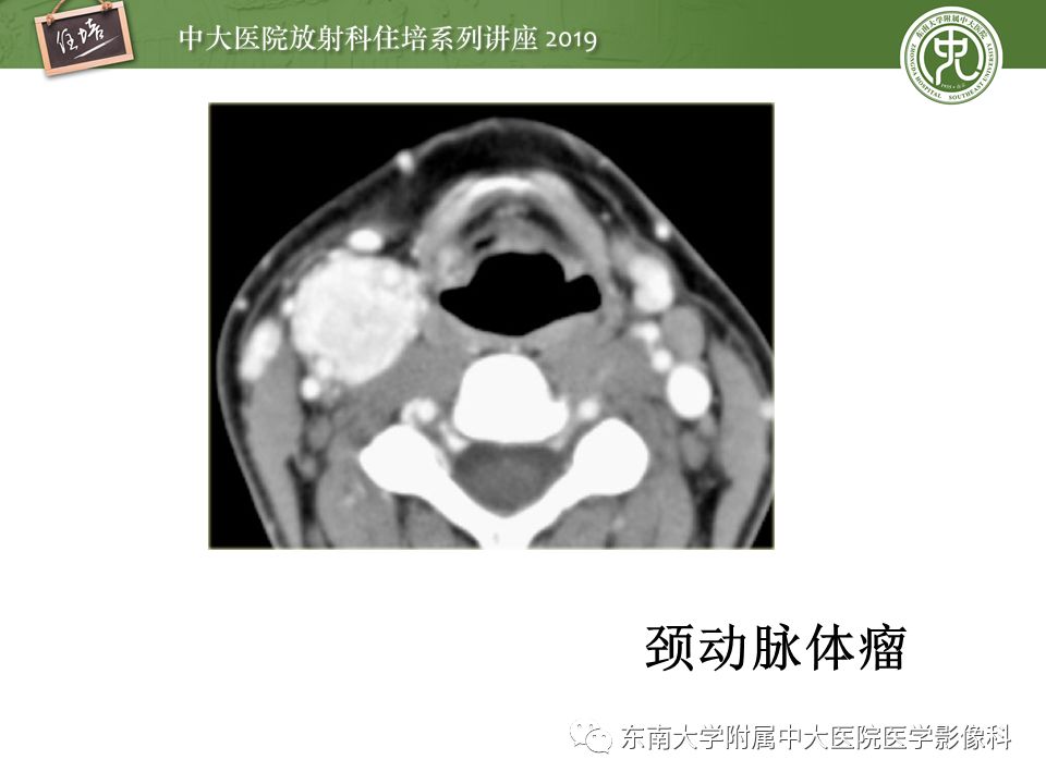 【PPT】颈部间隙的影像解剖及诊断思路