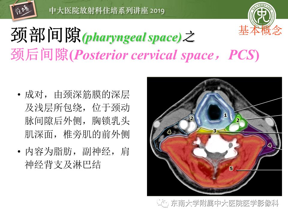【PPT】颈部间隙的影像解剖及诊断思路