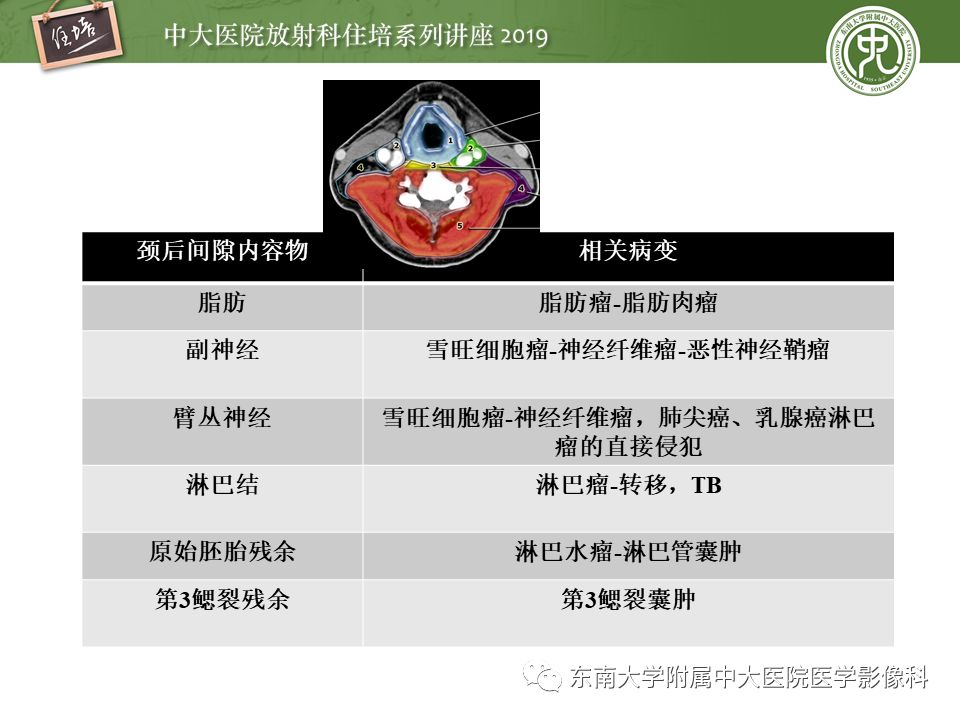 【PPT】颈部间隙的影像解剖及诊断思路