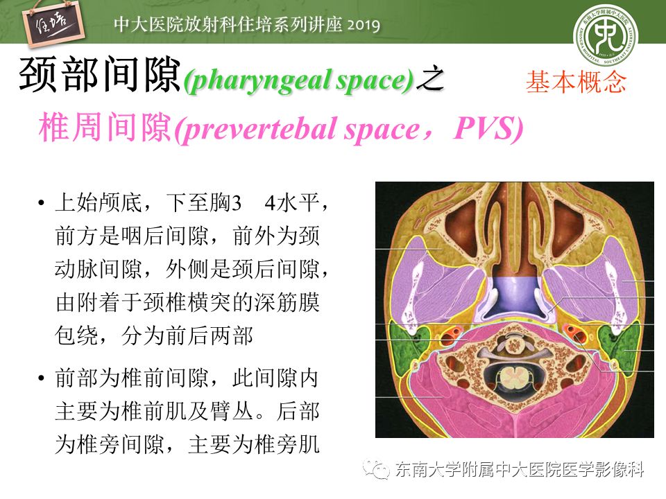 【PPT】颈部间隙的影像解剖及诊断思路