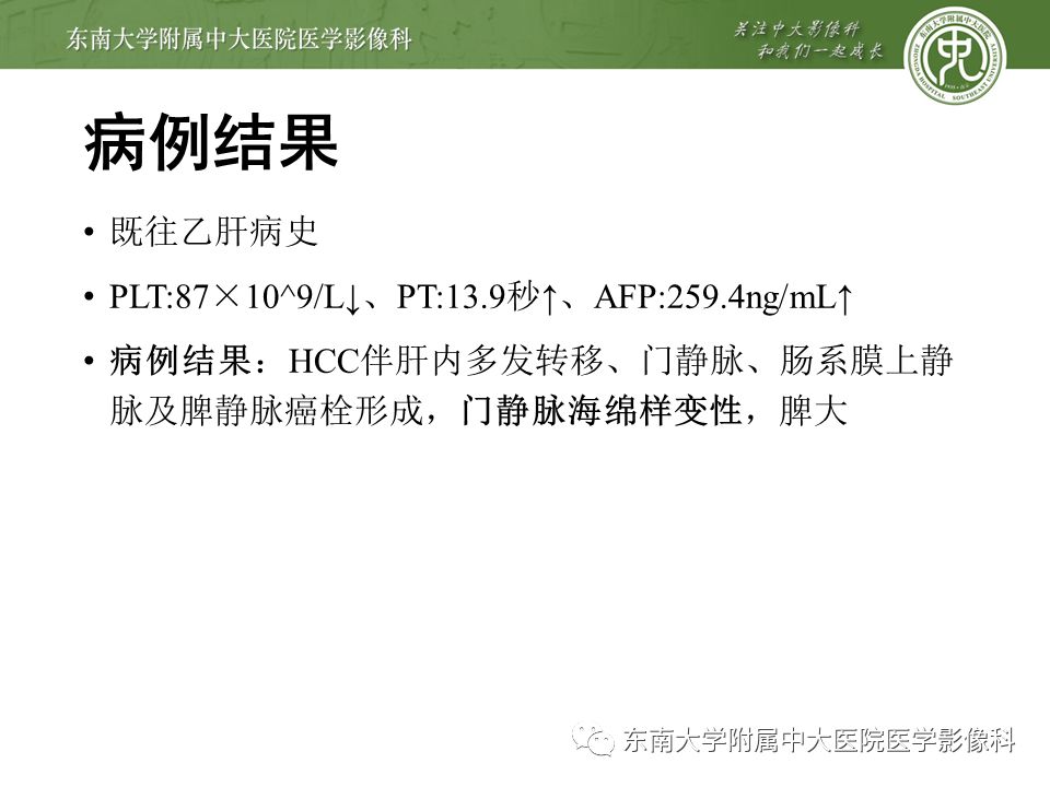 【病例】门静脉海绵样变性1例CT影像