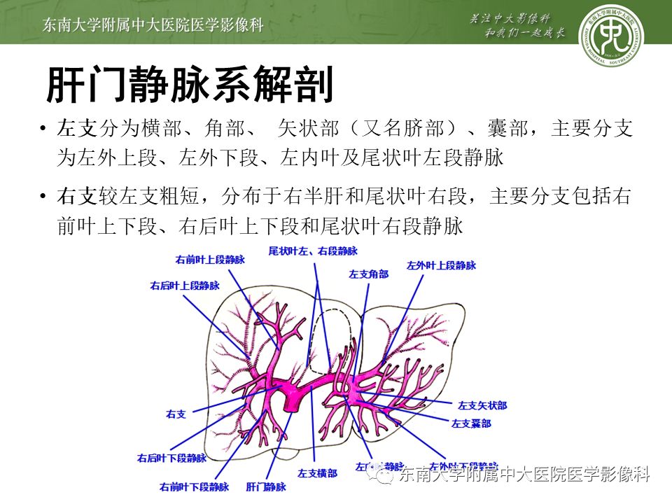 【病例】门静脉海绵样变性1例CT影像