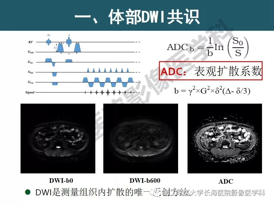 【PPT】体部DWI共识及胰腺DWI研究经验介绍