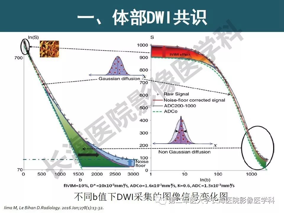 【PPT】体部DWI共识及胰腺DWI研究经验介绍