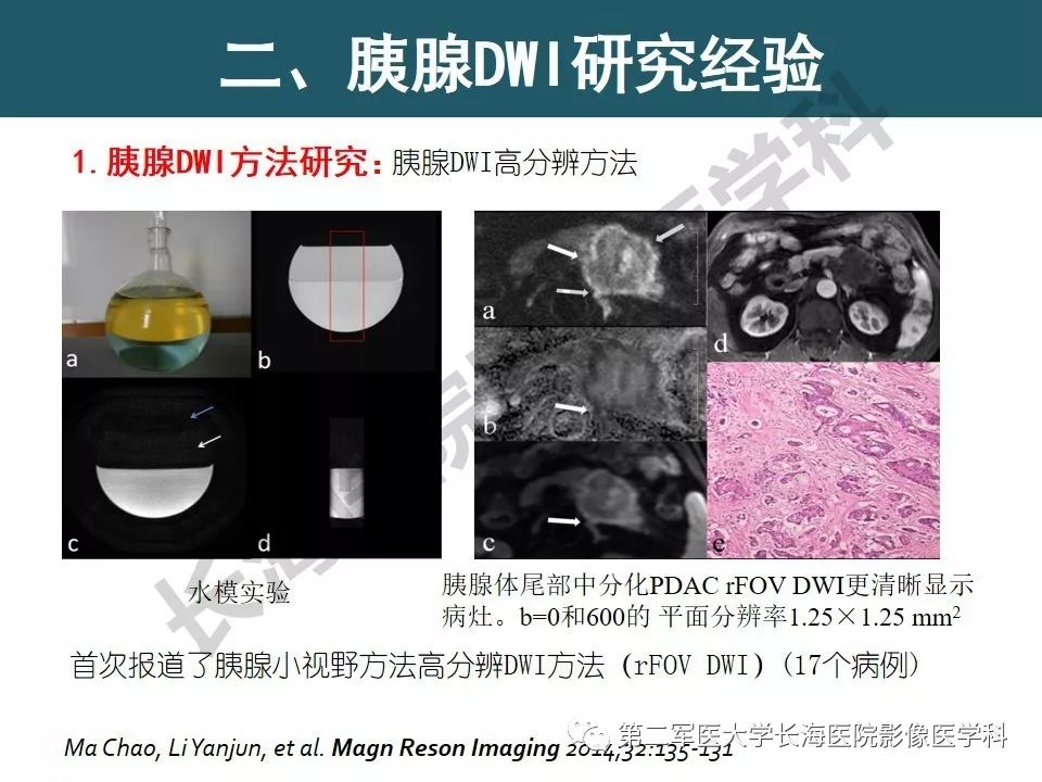 【PPT】体部DWI共识及胰腺DWI研究经验介绍
