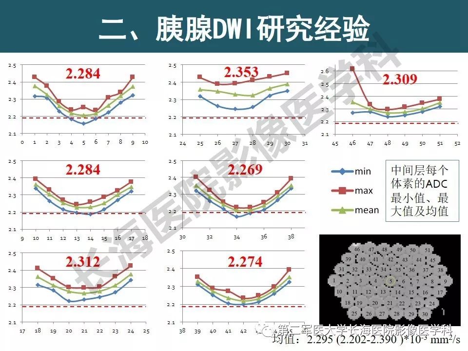 【PPT】体部DWI共识及胰腺DWI研究经验介绍