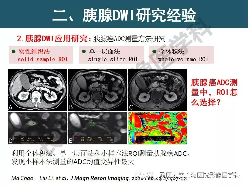 【PPT】体部DWI共识及胰腺DWI研究经验介绍