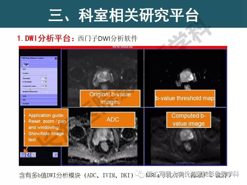 【PPT】体部DWI共识及胰腺DWI研究经验介绍