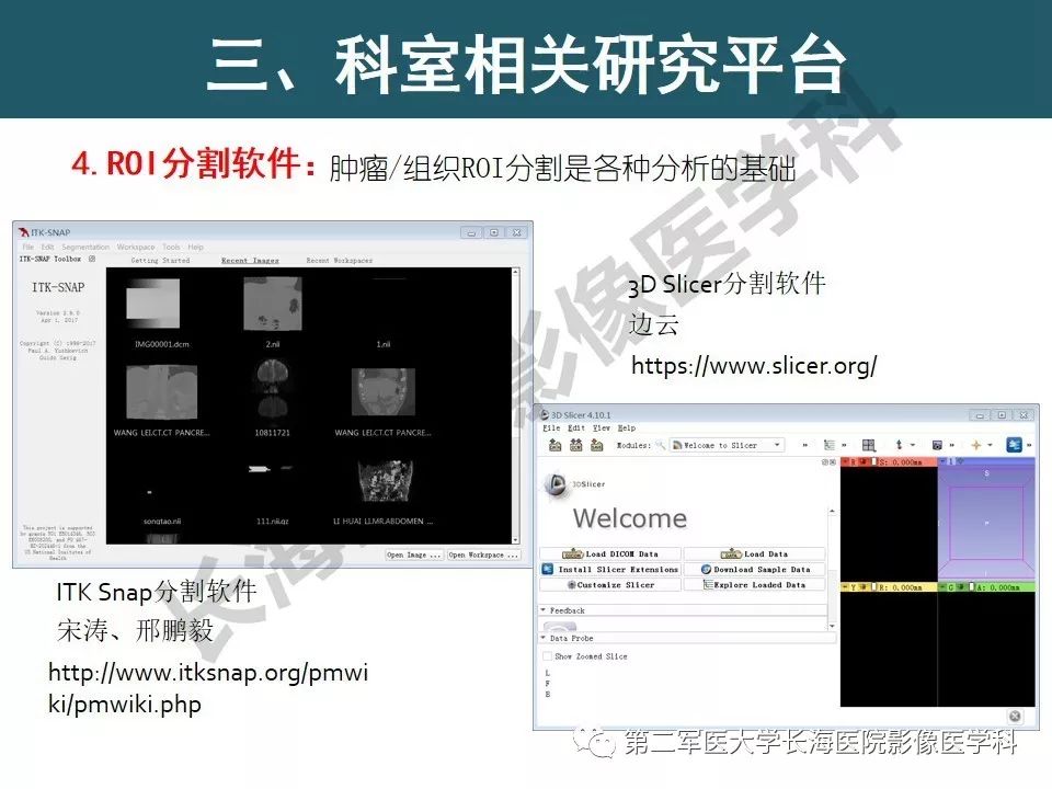【PPT】体部DWI共识及胰腺DWI研究经验介绍