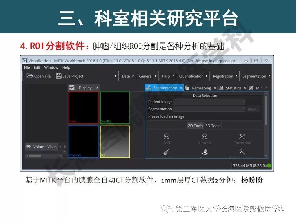 【PPT】体部DWI共识及胰腺DWI研究经验介绍