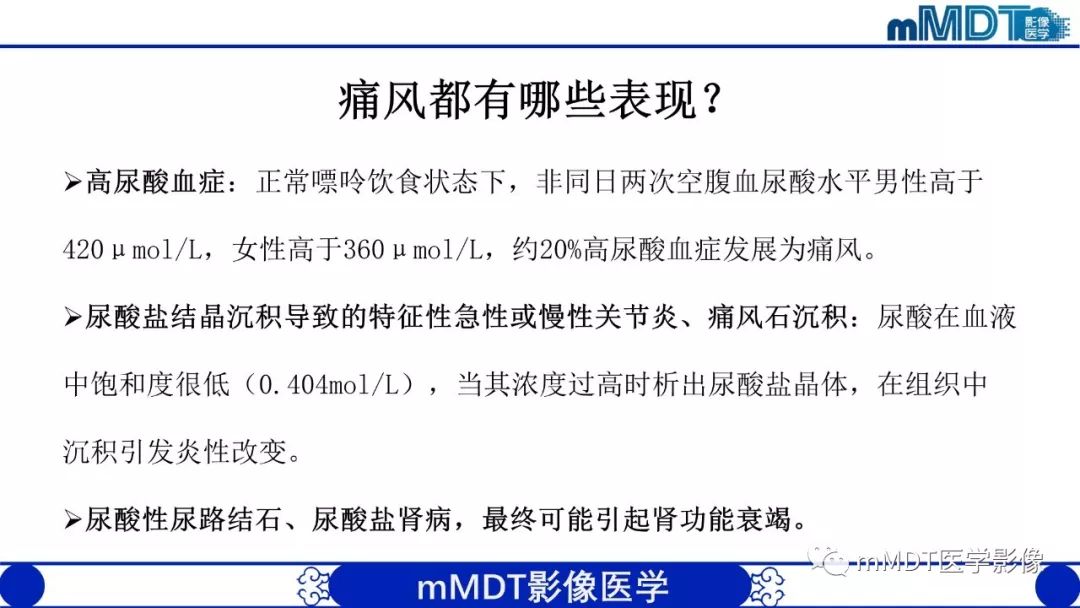 【PPT】痛风的影像学诊断与鉴别
