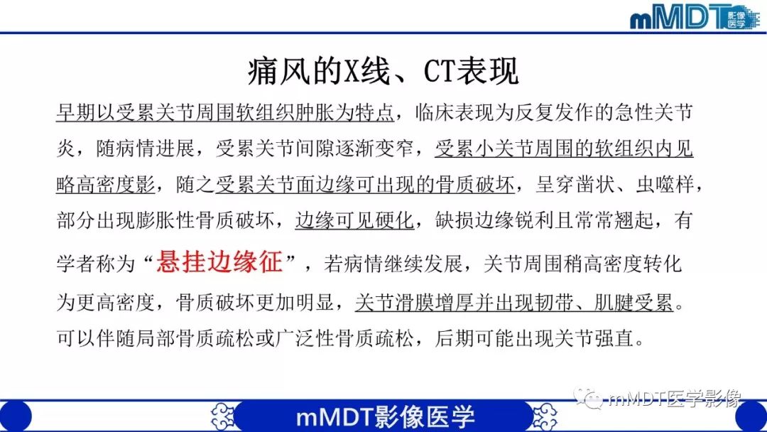 【PPT】痛风的影像学诊断与鉴别