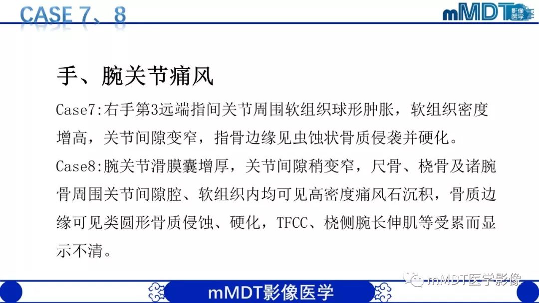 【PPT】痛风的影像学诊断与鉴别