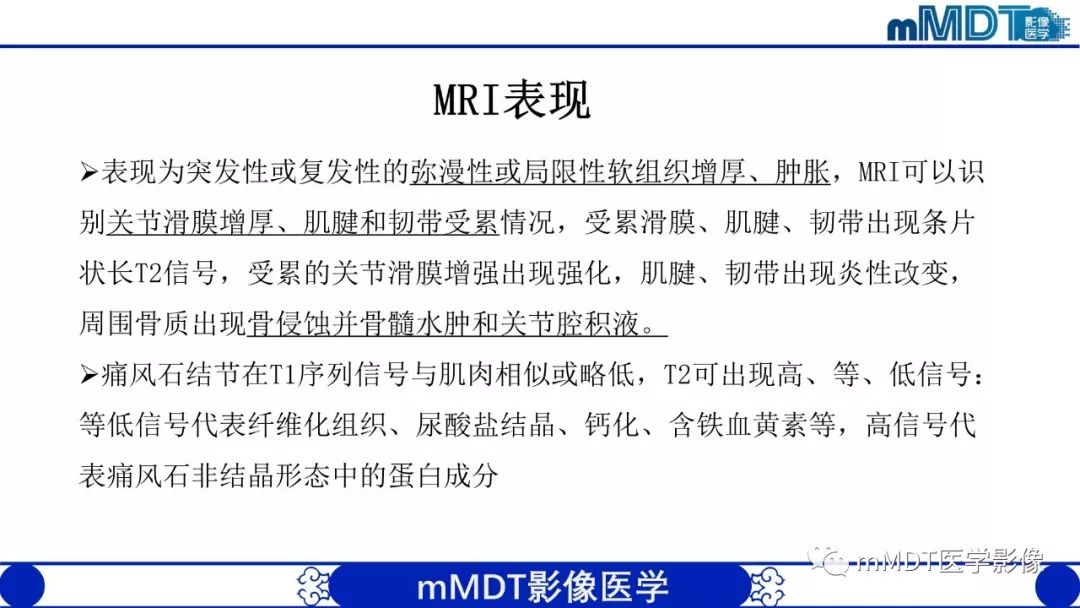 【PPT】痛风的影像学诊断与鉴别