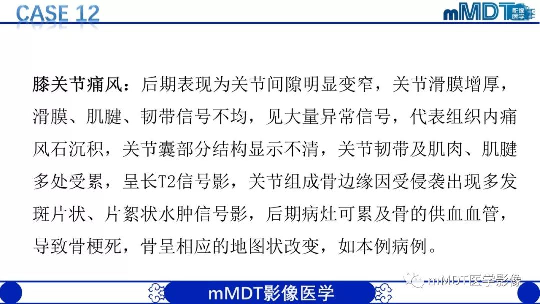 【PPT】痛风的影像学诊断与鉴别