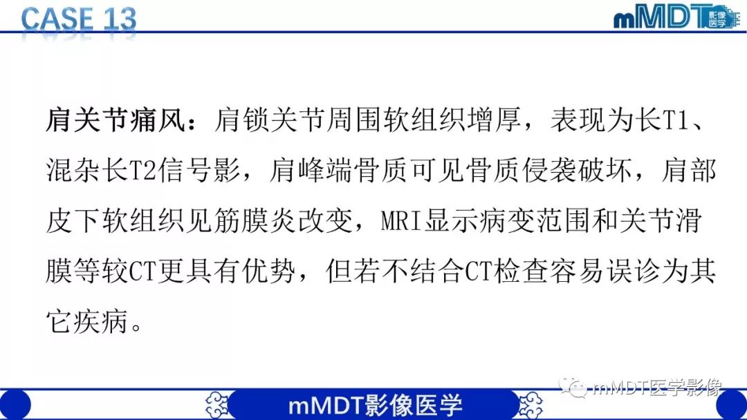 【PPT】痛风的影像学诊断与鉴别