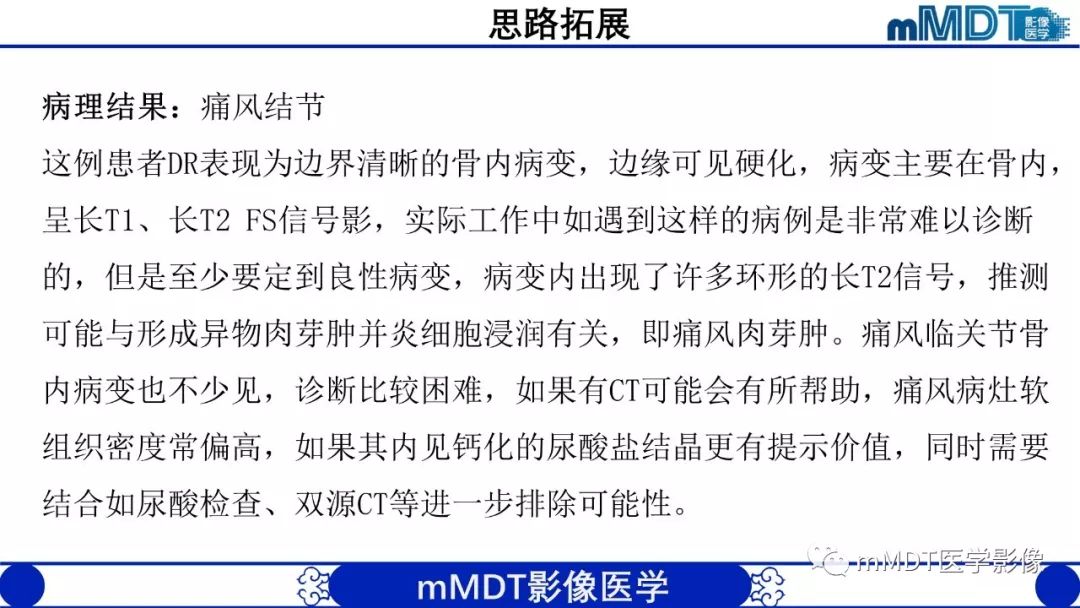 【PPT】痛风的影像学诊断与鉴别