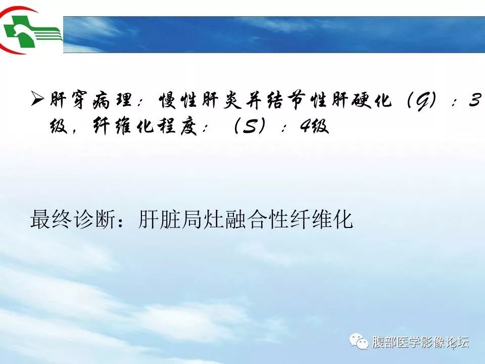 【病例】肝脏局灶融合性纤维化1例CT影像 【病例】肝脏局灶融合性纤维化1例CT影像