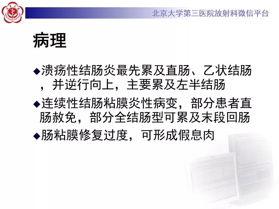 【病例】炎症性肠病-溃疡性结肠炎1例CT影像