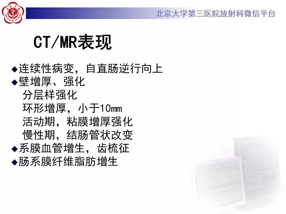 【病例】炎症性肠病-溃疡性结肠炎1例CT影像