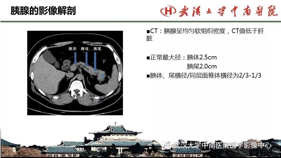【PPT】胰腺正常解剖及形态变异、先天性疾病