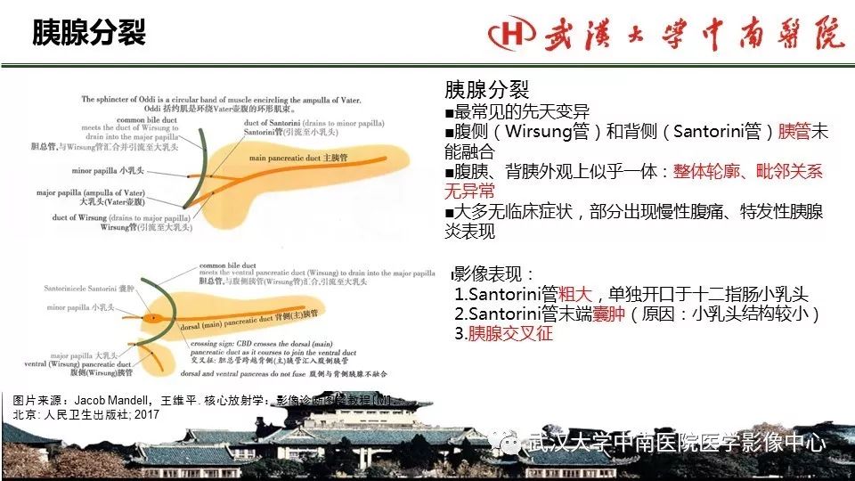 【PPT】胰腺正常解剖及形态变异、先天性疾病