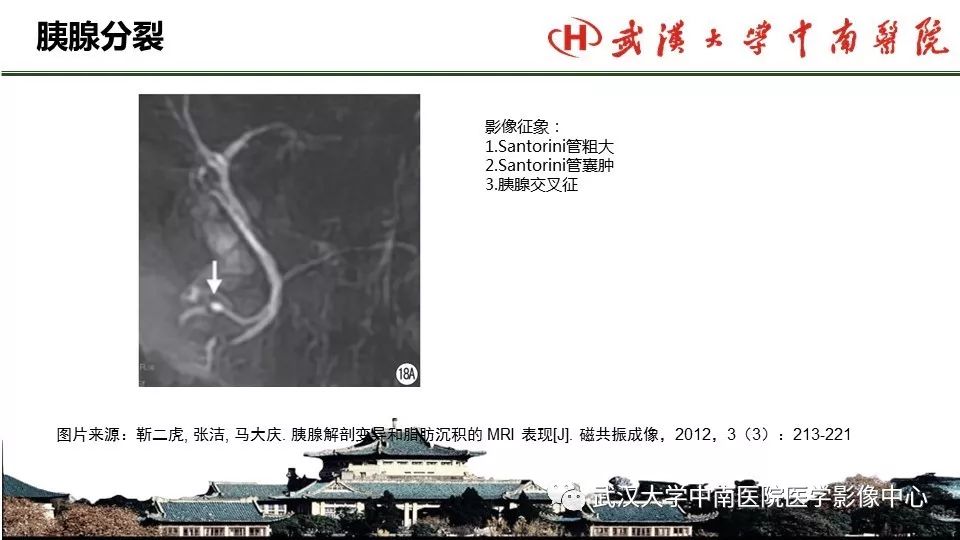 【PPT】胰腺正常解剖及形态变异、先天性疾病