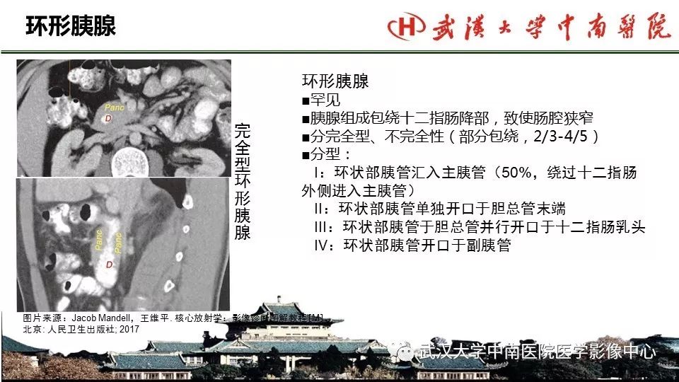 【PPT】胰腺正常解剖及形态变异、先天性疾病