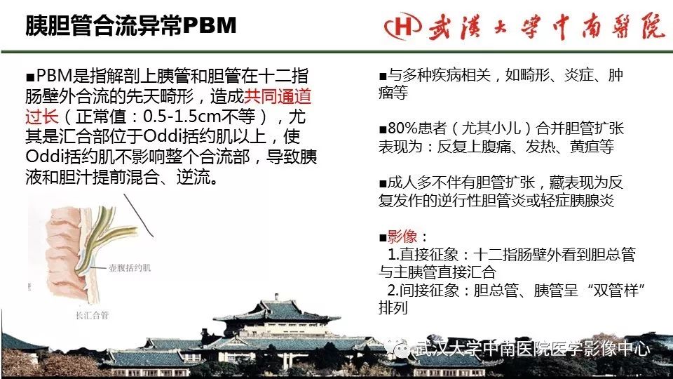 【PPT】胰腺正常解剖及形态变异、先天性疾病