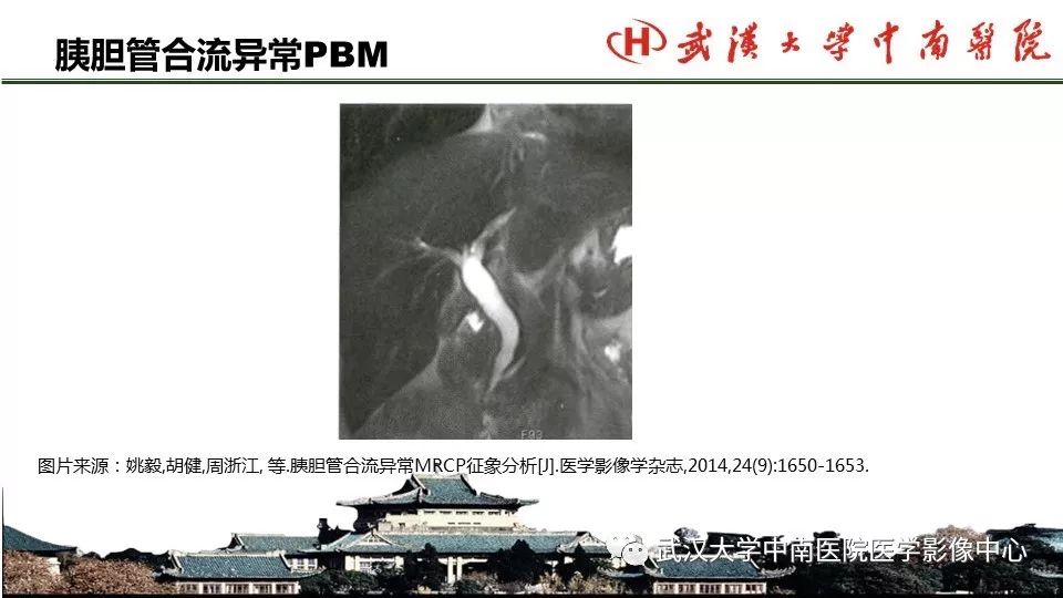 【PPT】胰腺正常解剖及形态变异、先天性疾病