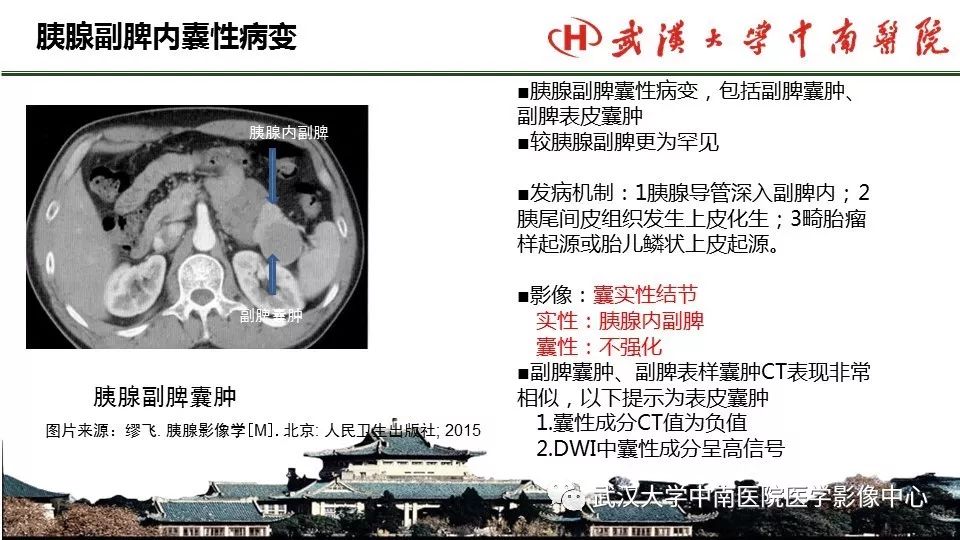 【PPT】胰腺正常解剖及形态变异、先天性疾病