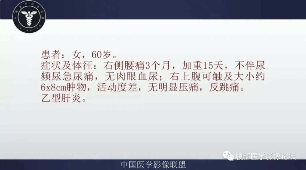 【病例】右肾嫌色细胞癌伴肉瘤样分化1例CT及MR影像