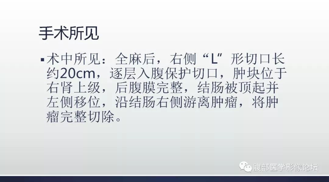 【病例】右肾嫌色细胞癌伴肉瘤样分化1例CT及MR影像
