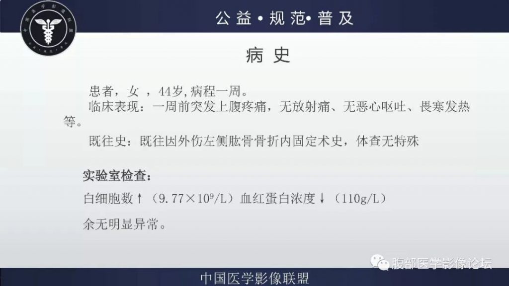 【病例】腹膜后神经鞘瘤及肝腺瘤1例CT
