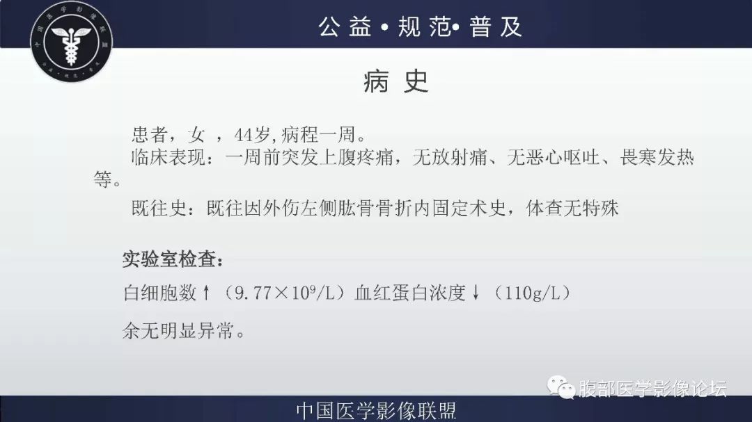 【病例】腹膜后神经鞘瘤及肝腺瘤1例CT