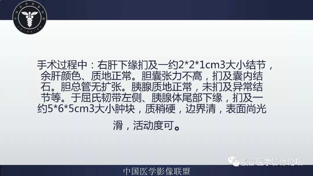 【病例】腹膜后神经鞘瘤及肝腺瘤1例CT