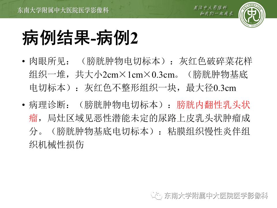 【病例】高级别乳头状尿路上皮癌VS膀胱乳头状瘤各1例CT