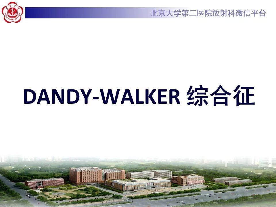 【病例】Dandy-Walker综合征1例CT及MR影像