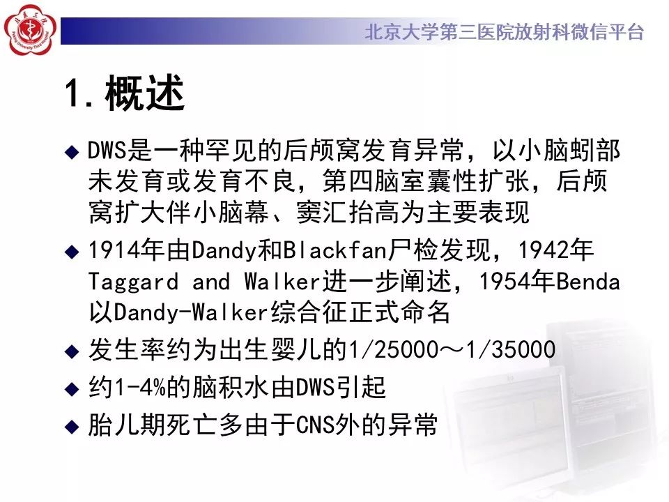 【病例】Dandy-Walker综合征1例CT及MR影像