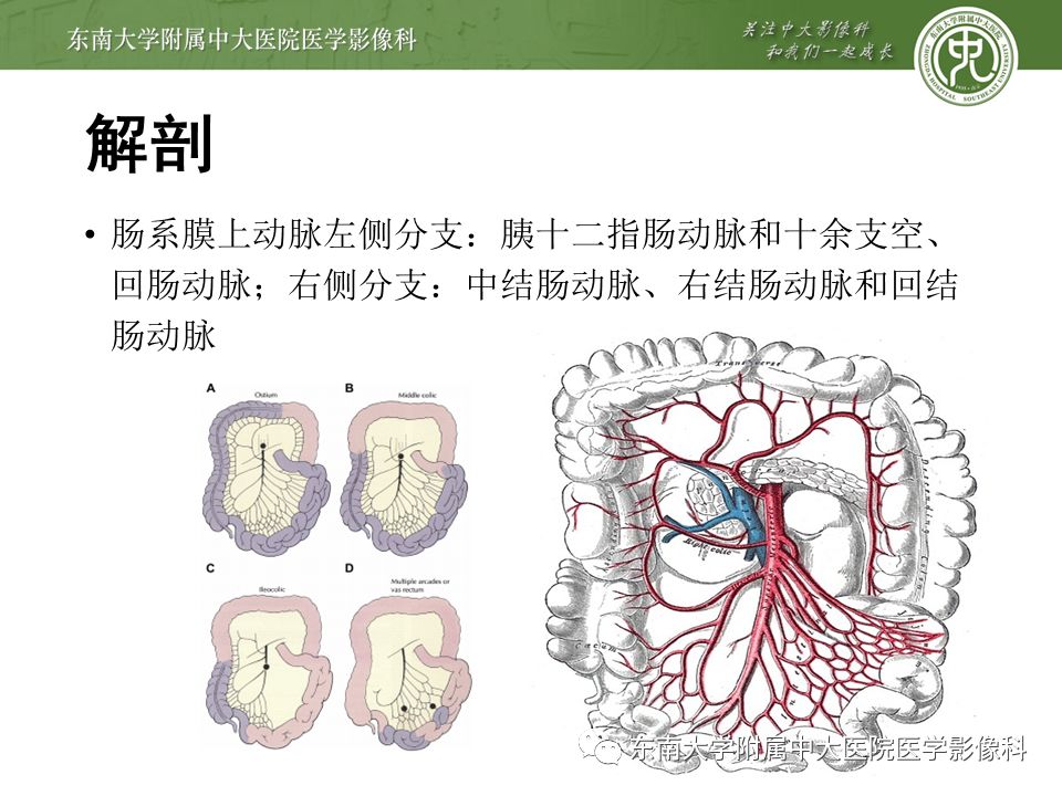 【病例】肠系膜上动脉栓塞2例CT影像
