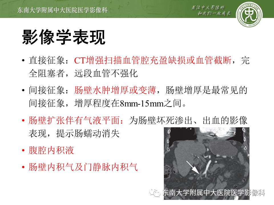 【病例】肠系膜上动脉栓塞2例CT影像