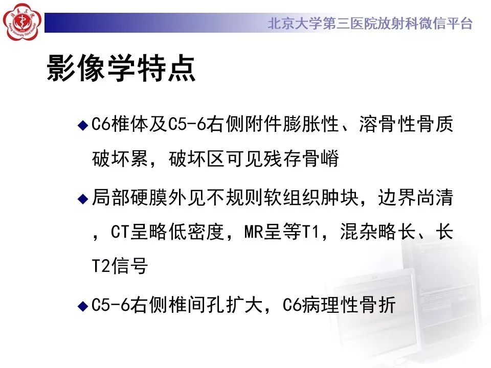 【病例】脊柱神经鞘瘤1例CT及MR