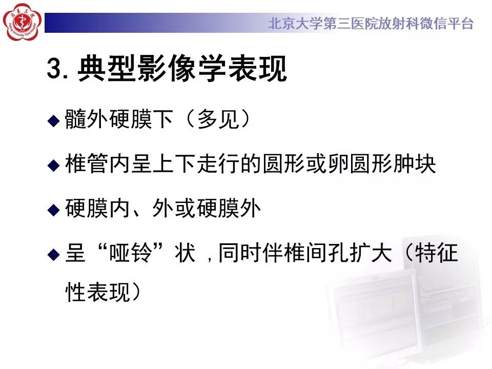 【病例】脊柱神经鞘瘤1例CT及MR